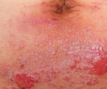 04YBAGEDUyqAWRYvAABNfp3t2no253 04YBAGEDUyqAWRYvAABNfp3t2no253