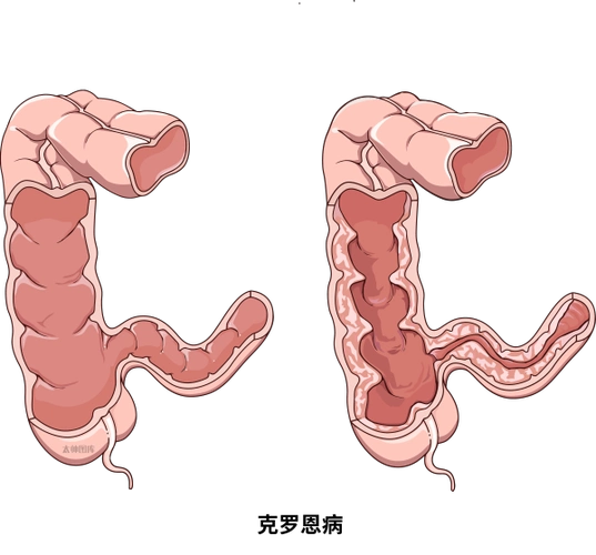 u=833765107,1440847433&fm=253&fmt=auto&app=138&f=PNG u=833765107,1440847433&fm=253&fmt=auto&app=138&f=PNG